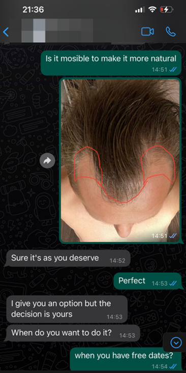 whatsapp clinique de greffe de cheveux 4