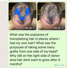 message whatsapp clinique de greffe de cheveux 6